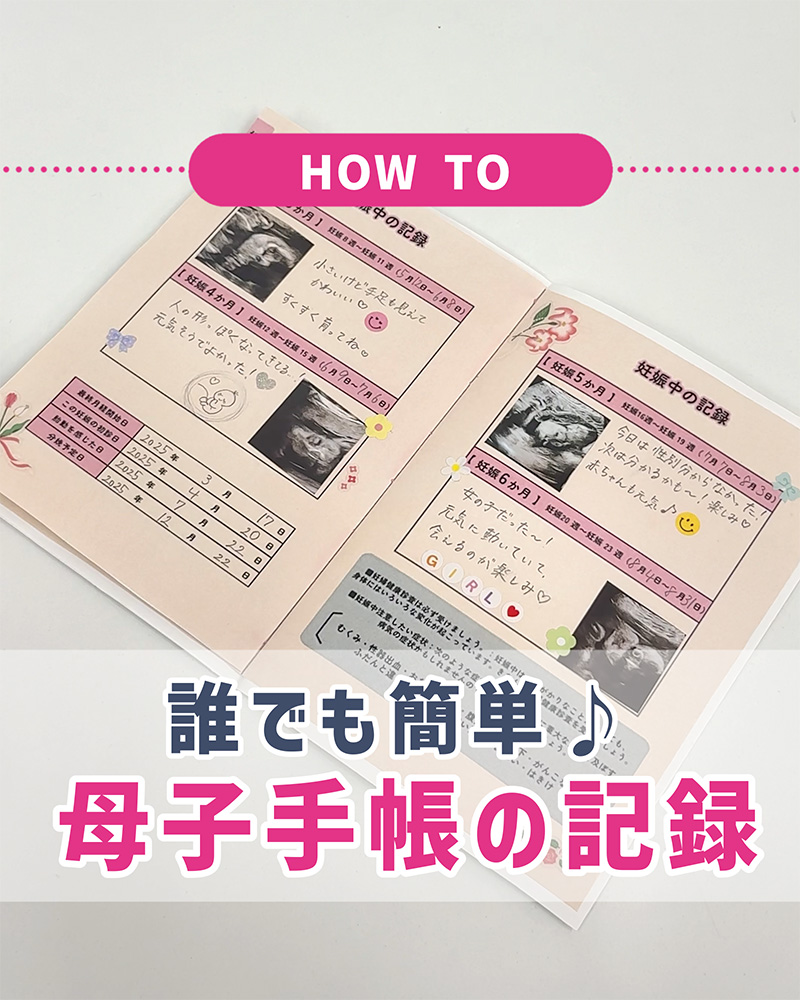 エコー写真の正しい保管方法とかわいい活用アイデア 母子手帳にも貼れる！